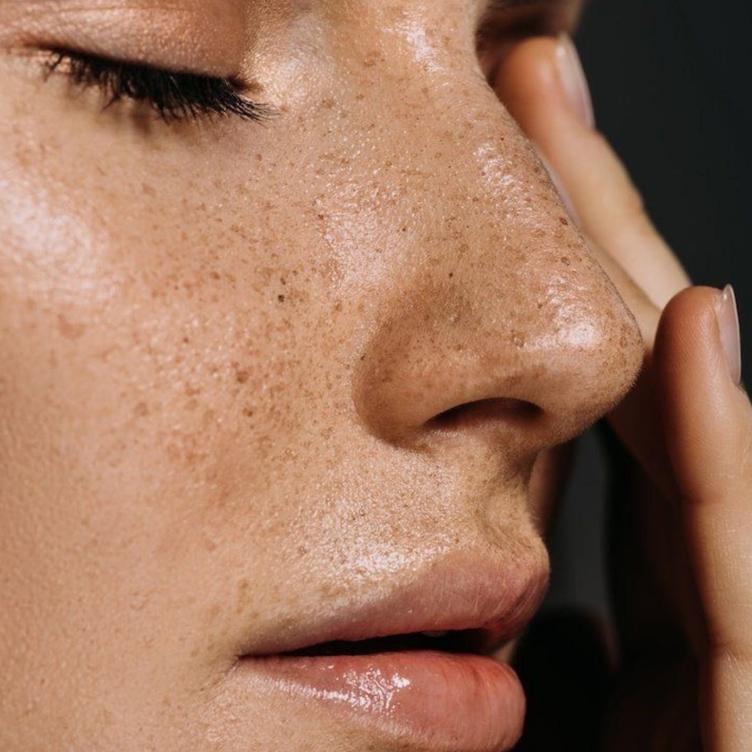 Close-up of glowing, freckled skin with hand gently touching cheek, htdrated with rosehip face oil